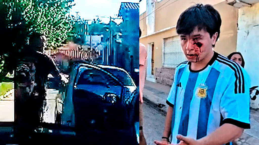 Turistas asistieron a Joven que fue agredido por otro automovilista