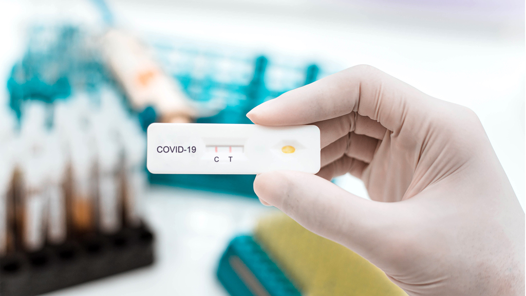 Test rápidos de antígeno para frenar la segunda ola de COVID-19